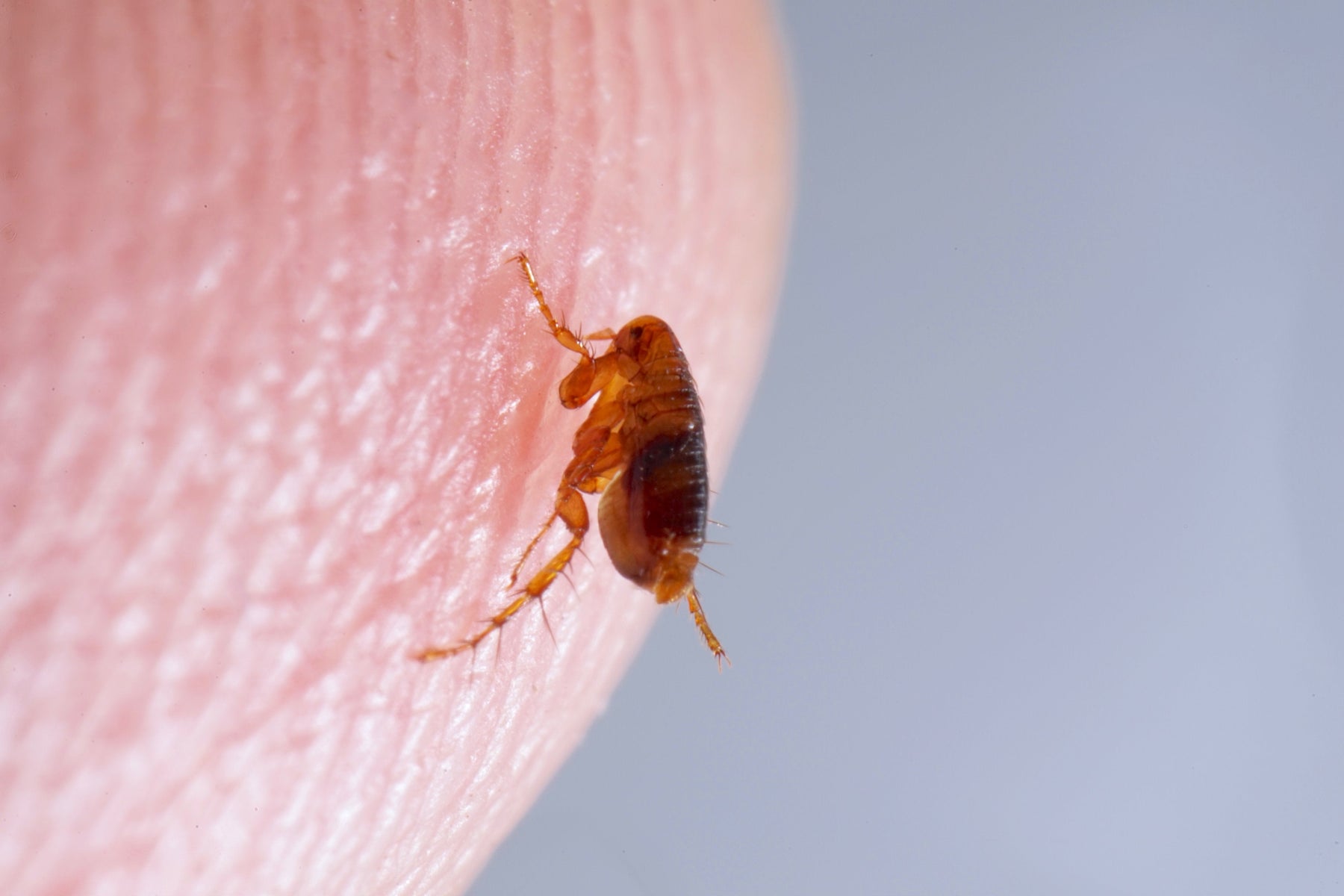 Come sbarazzarsi delle pulci sugli esseri umani: consigli e trucchi efficaci 