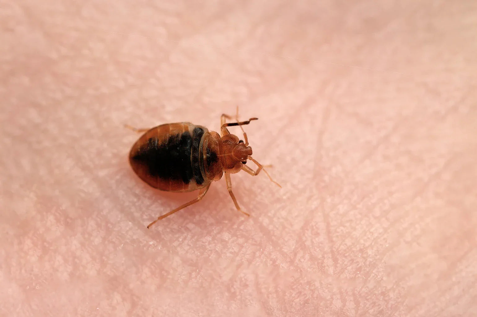 Le cimici dei letti si attaccano al corpo? 