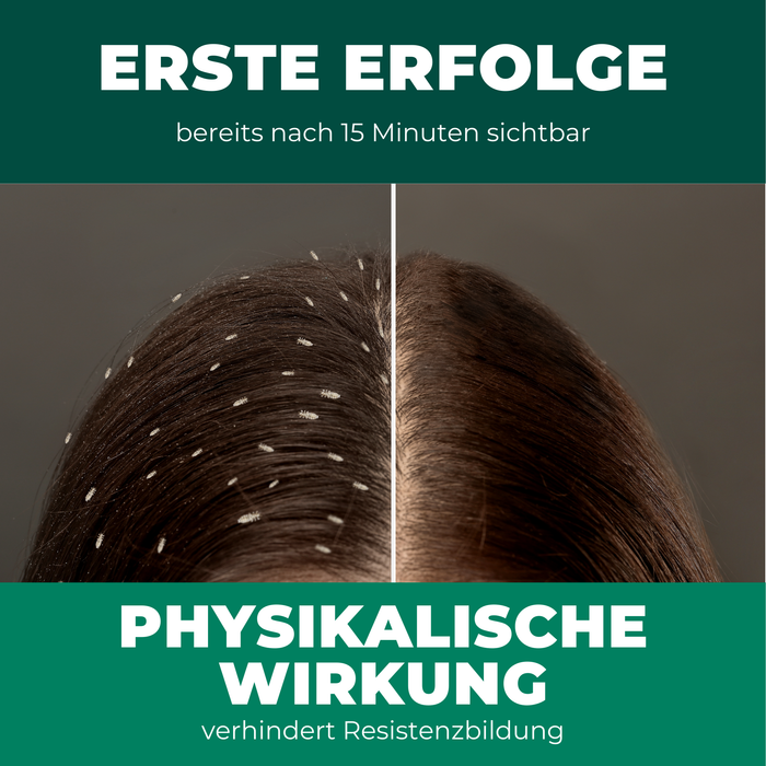 Shampoo per pidocchi - shampoo per pidocchi per bambini e adulti, incluso shampoo per pidocchi a pettine