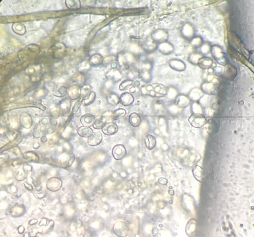 Chaetomium globosum — Bild 3