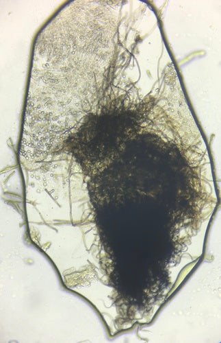 Chaetomium globosum — Bild 5
