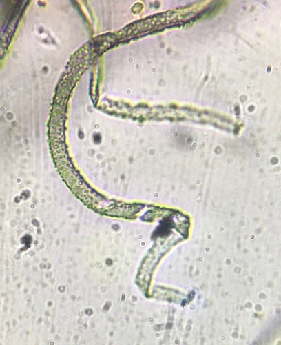 Chaetomium globosum — Bild 4