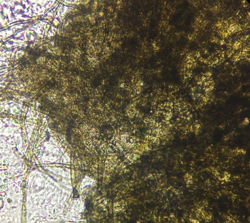 Chaetomium globosum — Bild 3