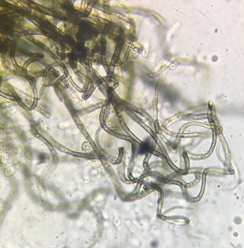 Chaetomium globosum — Bild 2