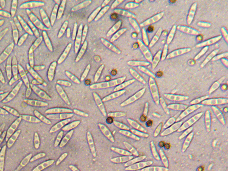 Fusarium — foto 1 di 8