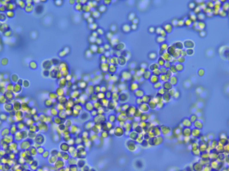 Mucor (muffa della testa) — foto 2 di 2