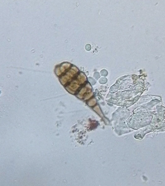 Alternaria — foto 5 di 8