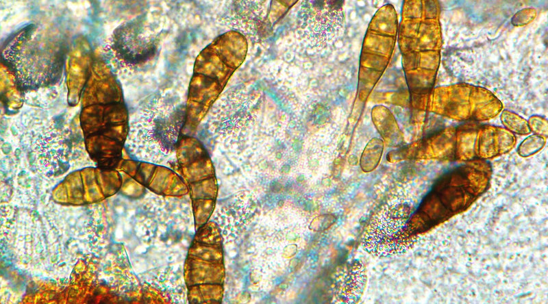 Alternaria — foto 1 di 8