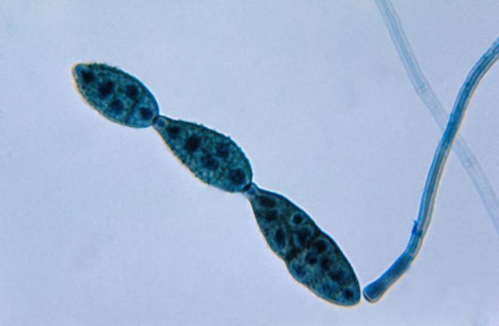 Alternaria — foto 2 di 8