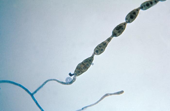 Alternaria — foto 3 di 8