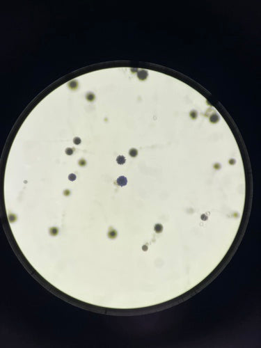 L'annaffiatoio nero ammuffisce — Bild 4